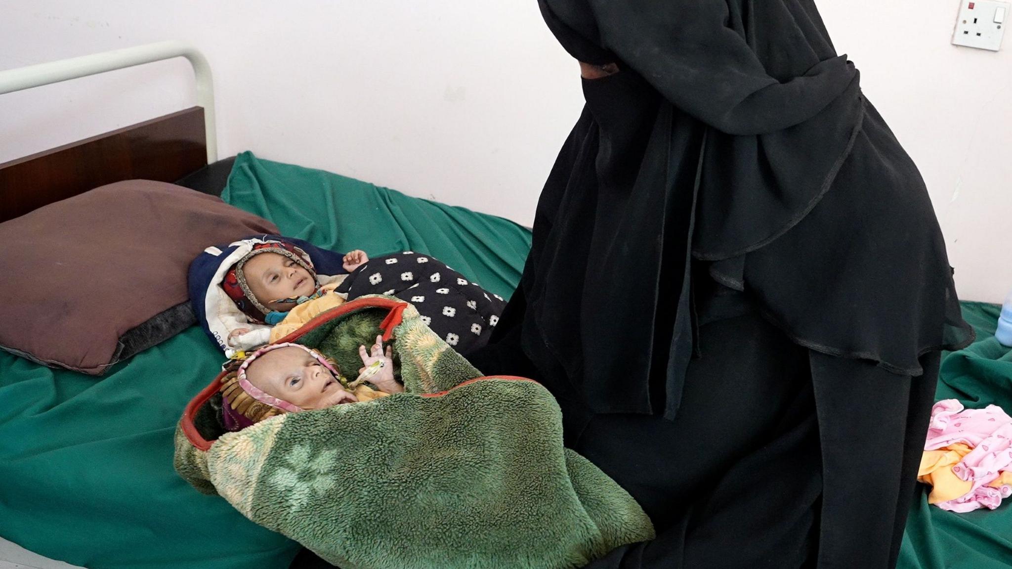 Raad Hassan held by his mother Lina, while twin sister Raghad lies beside him on a bed at a hospital in Aden, Yemen