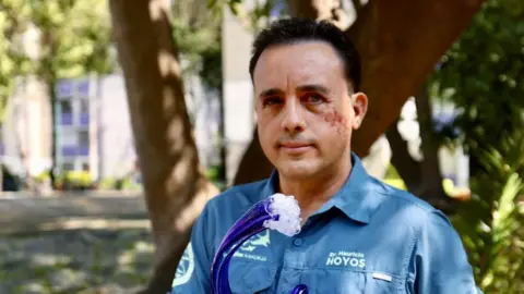 Shark Bite Survivor: Biologist Plans to Meet the Shark Again