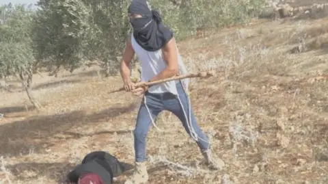 Unprovoked Attack Leaves Palestinian Woman Hospitalized in West Bank