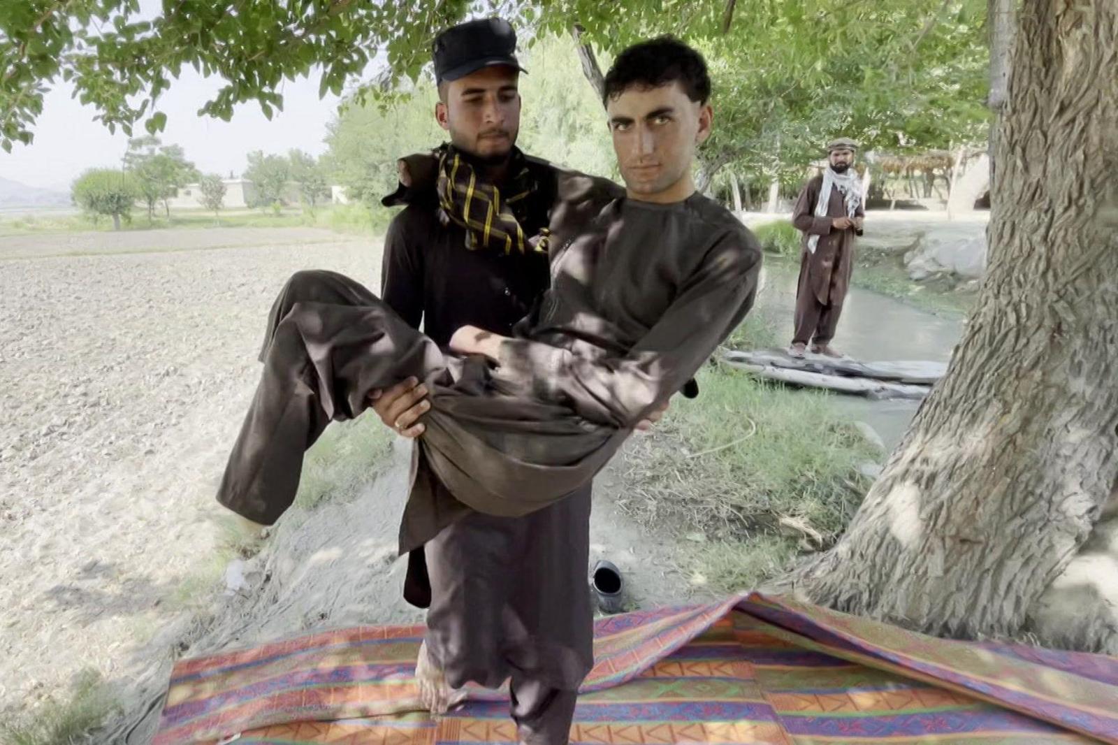 A young Afghan amputee, Shahsawar, lies on a rug; his hands and legs are missing.