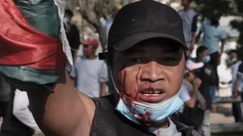 Madagascar Faces Power Struggle Amid Protests and Military Claims