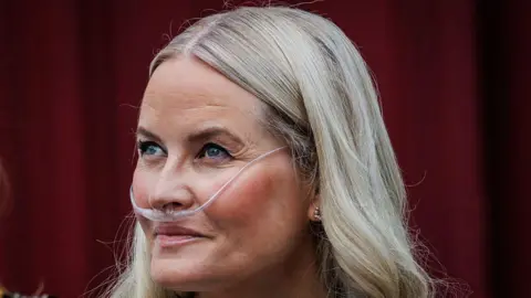 Norway’s Crown Princess Undergoes Successful Lung Transplant